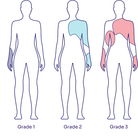 Maculopapular Rash Grades